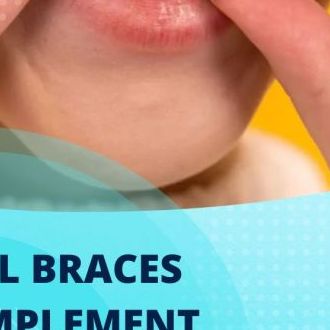 Get Dental Braces at Mainstreet Dental in Ballarat