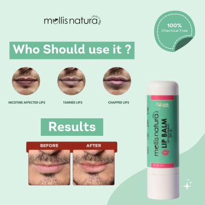 Learn about Mollis Natura's Best Lip Balm for Smokers, the option dermatologists advise for smokers' lips. This solution was created specifically for smokers to nourish and protect their lips while offering the utmost moisture and care. Join us in enhancing your lip care regimen.  Visit US:https://www.mollisnatura.com/products/hydrating-booster-lip-balm-for-dark-lips