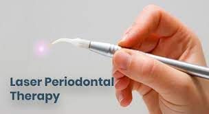 alabama periodontics